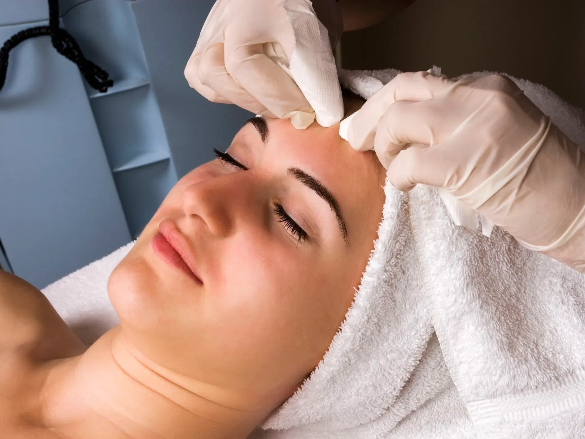 What is blackheads and how it harms our beauty?