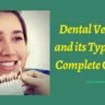 Dental Veneers and its Types - A Complete Guide
