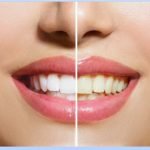 5 Must-Have Products for Maintaining Whiter Teeth