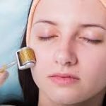 Demystifying Skin Needling: What To Expect And How It Transforms Your Complexion