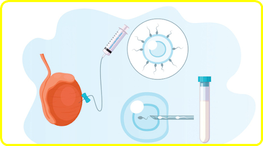 When should I go for the TESA procedure?