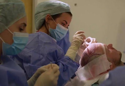 Discover the Best Hair Transplantation Solutions with Hairtec